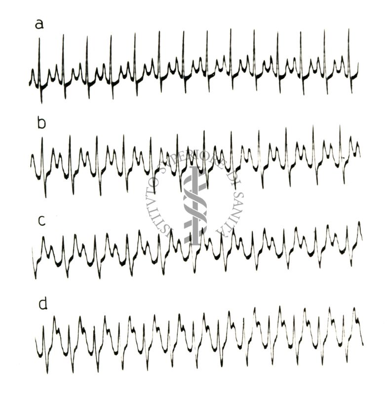 Lavoro sul 2099 I.S. - Derivato del Bispidoli Cardio Tossico