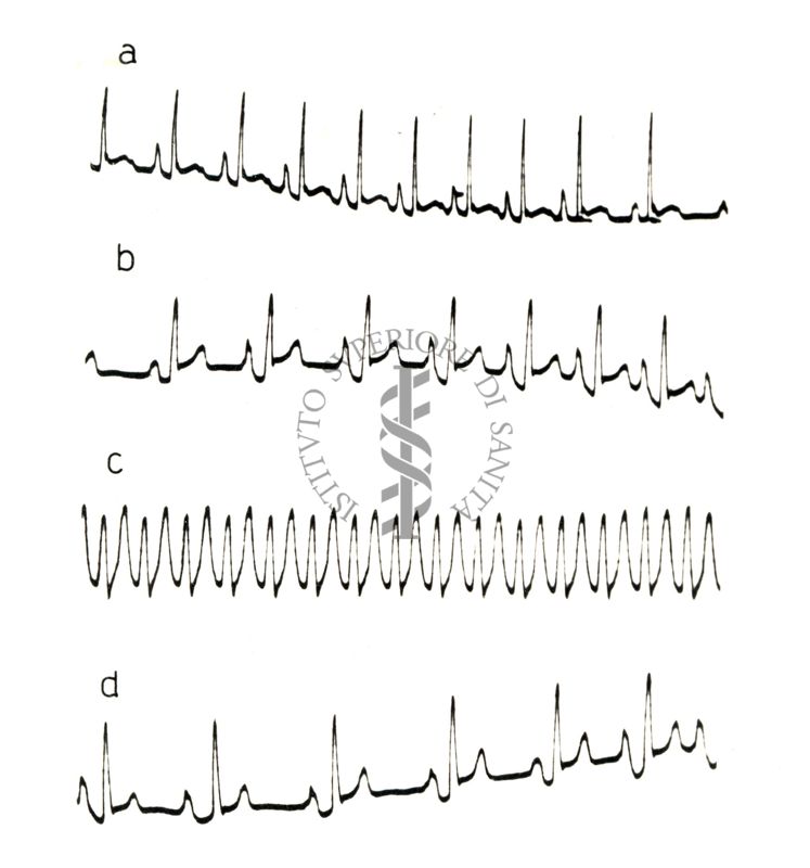 Lavoro sul 2099 I.S. - Derivato del Bispidoli Cardio Tossico