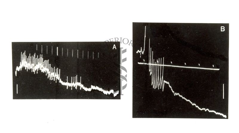 Registrazione con micro-elettrodi da singole cellule del midollo spinale