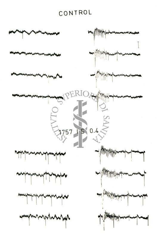 Registrazione con micro-elettrodi da singole cellule del midollo spinale