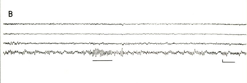 Elettroencefalogrammi di coniglio