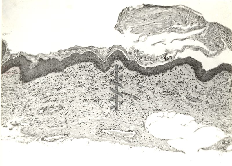 Elettroencefalogrammi di coniglio