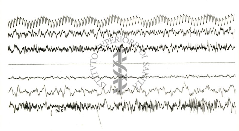 Elettroencefalogrammi di coniglio