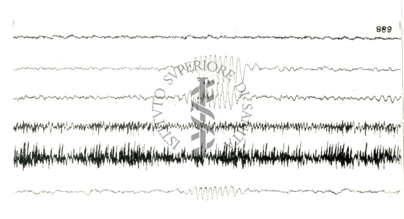 Elettroencefalogrammi di coniglio