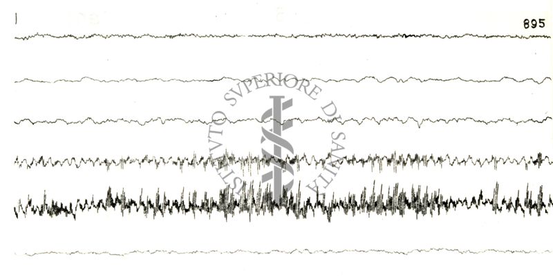 Elettroencefalogrammi di coniglio