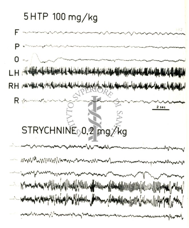 Elettroencefalogrammi di coniglio