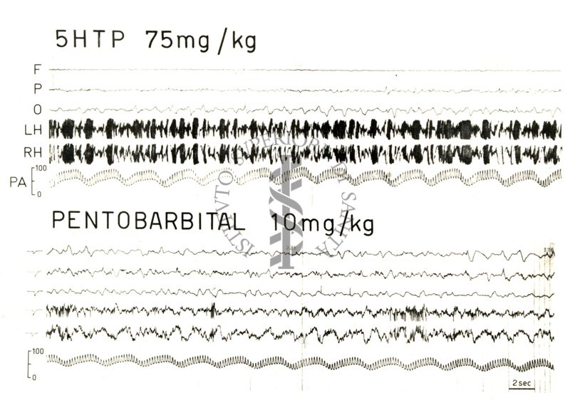 Elettroencefalogrammi di coniglio