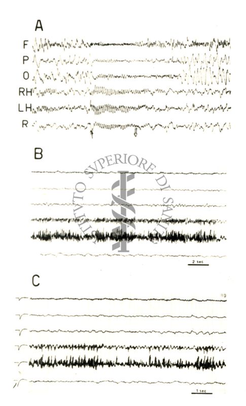 Elettroencefalogrammi di coniglio