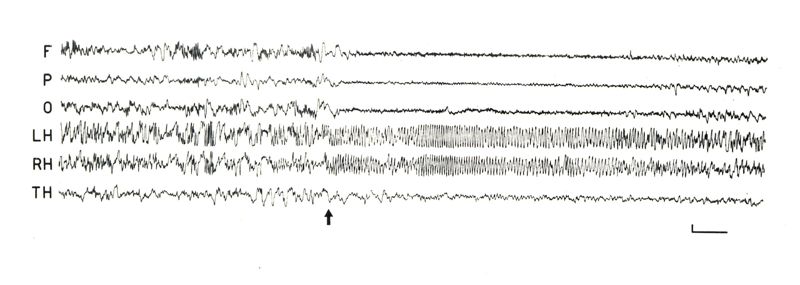 Elettroencefalogrammi di coniglio