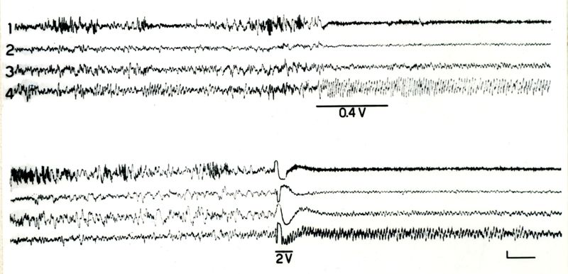 Elettroencefalogrammi di coniglio