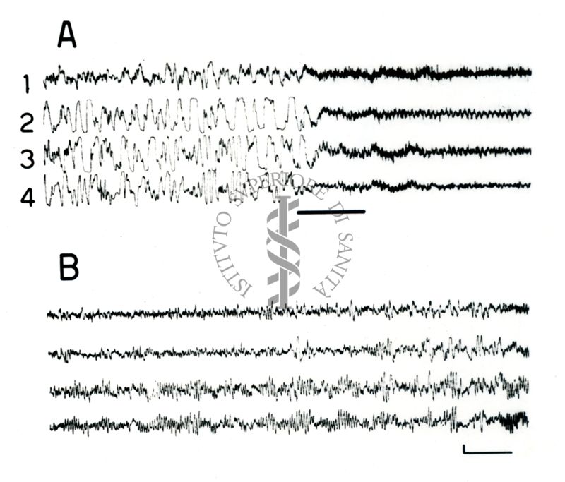 Elettroencefalogrammi di coniglio