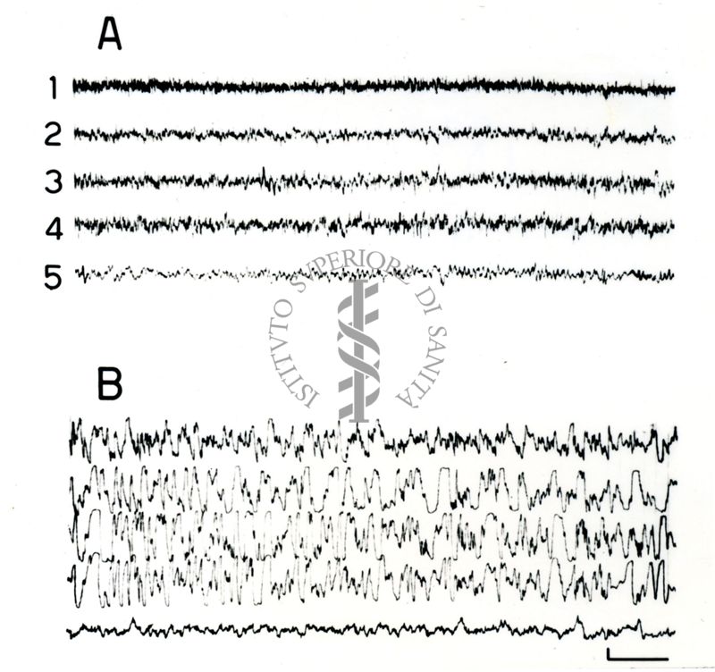 Elettroencefalogrammi di coniglio