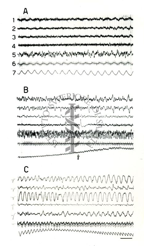 Elettroencefalogrammi di coniglio