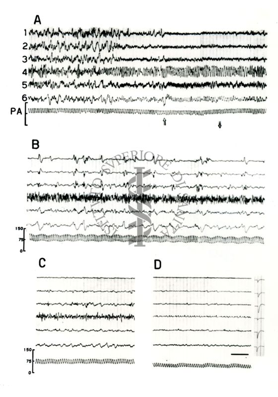 Elettroencefalogrammi di coniglio