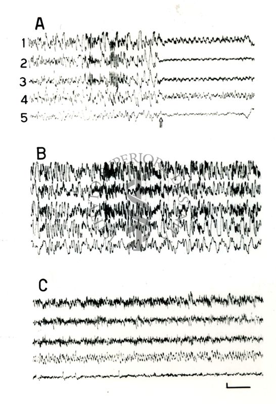 Elettroencefalogrammi di coniglio