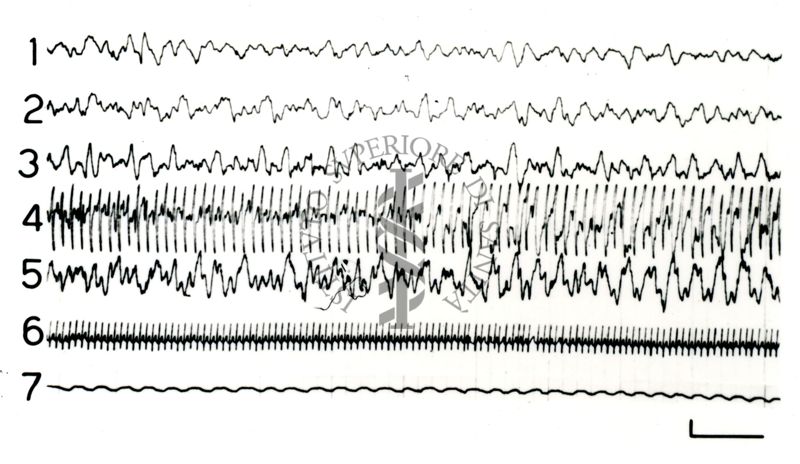 Elettroencefalogrammi di coniglio