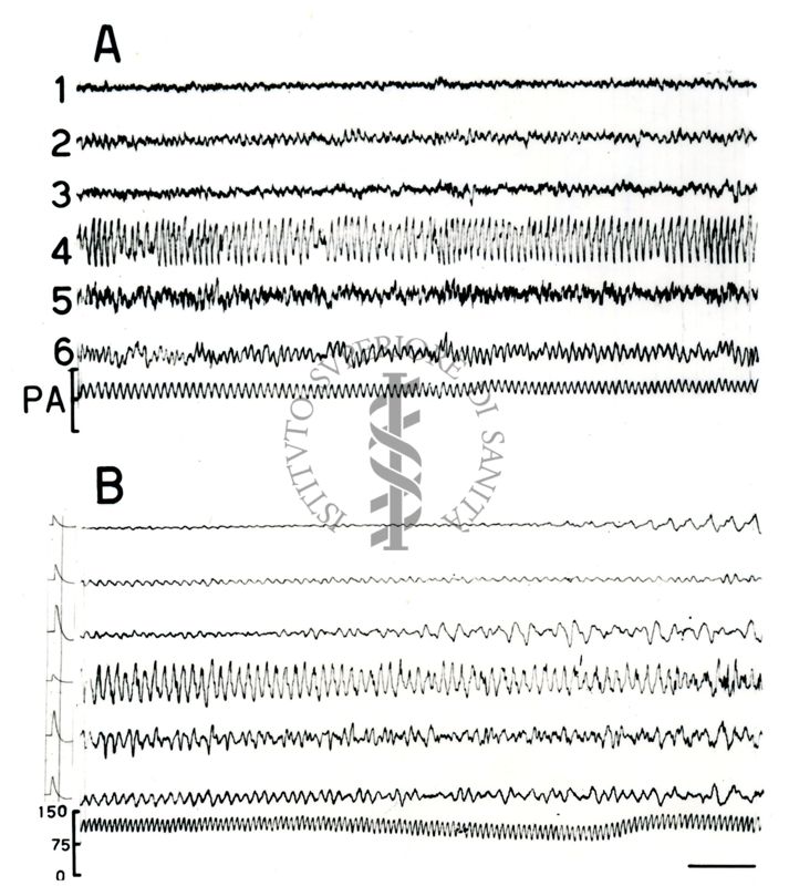 Elettroencefalogrammi di coniglio