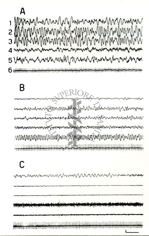 Elettroencefalogrammi di coniglio