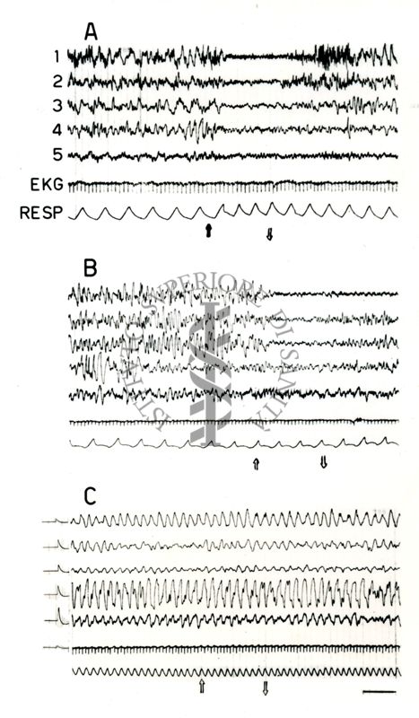 Elettroencefalogrammi di coniglio