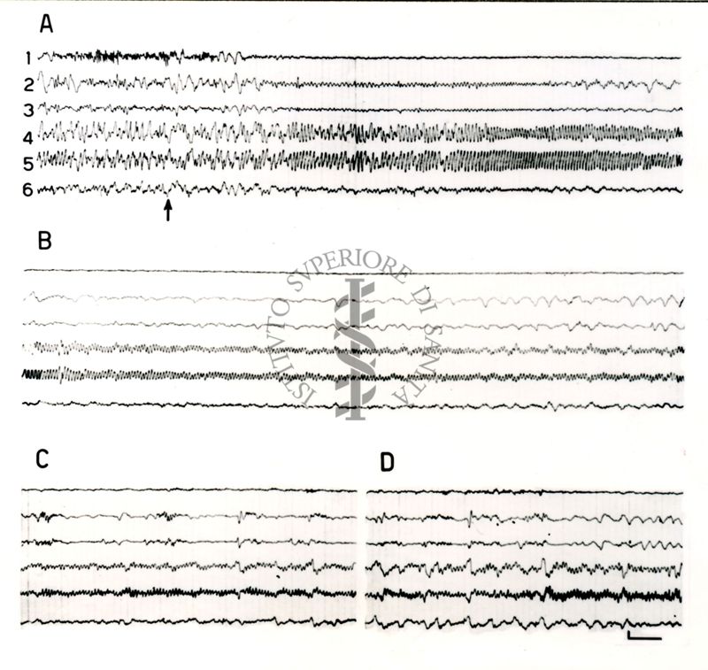 Elettroencefalogrammi di coniglio