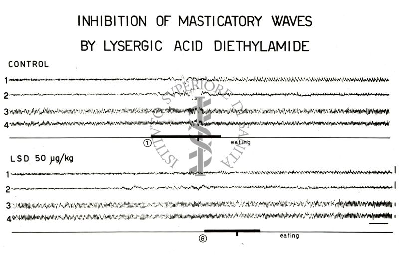 Elettroencefalogrammi di coniglio