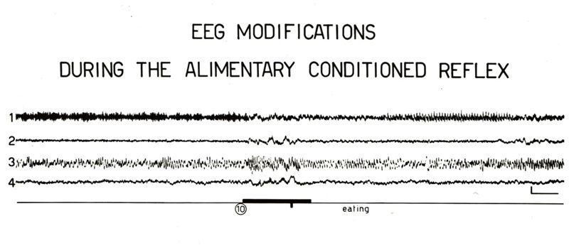 Elettroencefalogrammi di coniglio