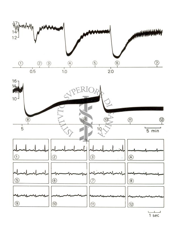 Tracciati elettroencefalografici