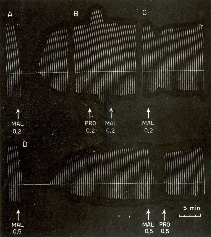 Tracciati elettroencefalografici