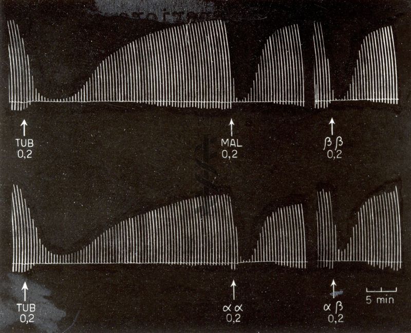 Tracciati elettroencefalografici