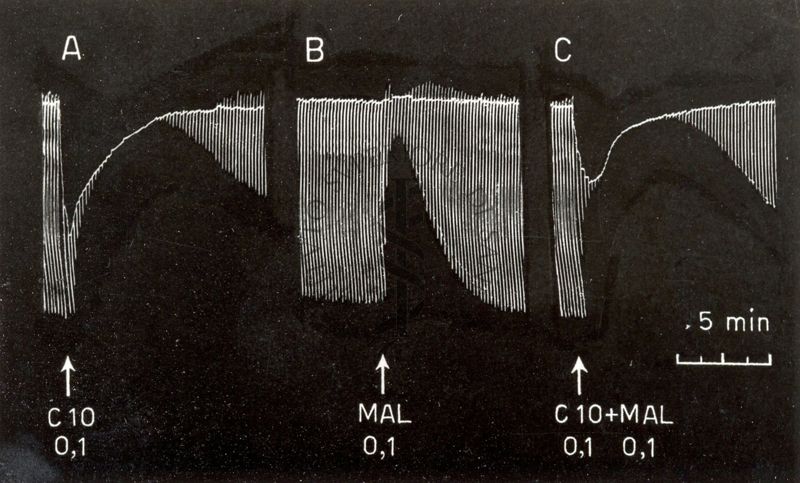 Tracciati elettroencefalografici