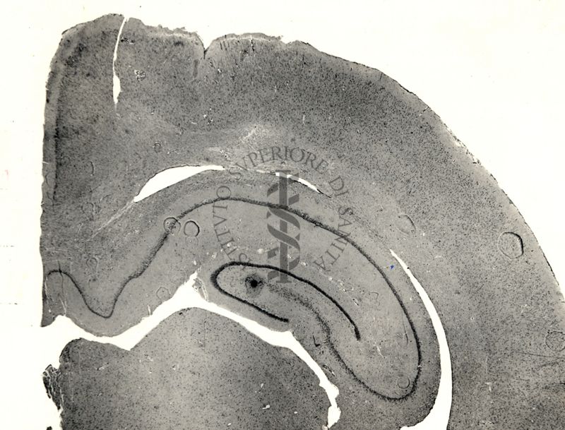 Sezioni di cervello di coniglio