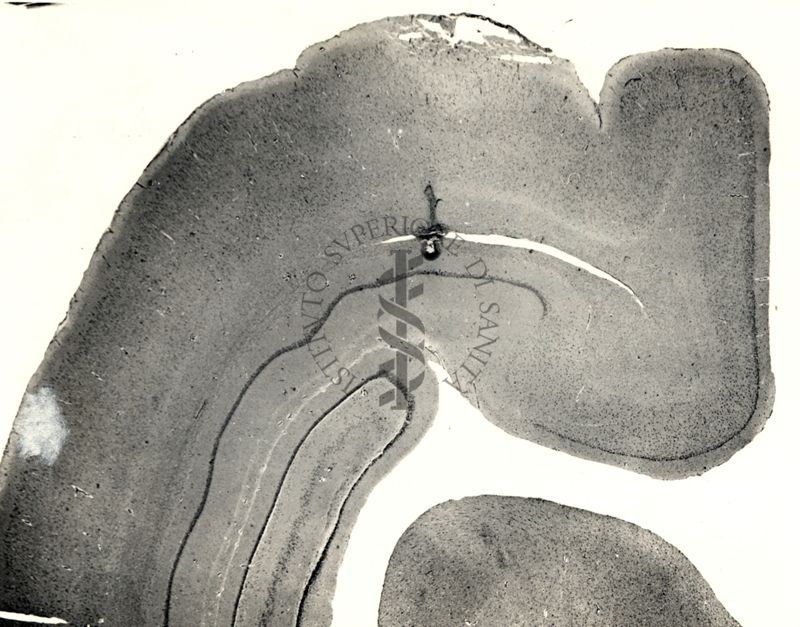 Sezioni di cervello di coniglio