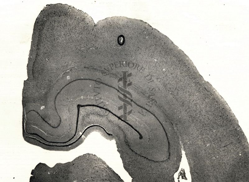 Sezioni di cervello di coniglio