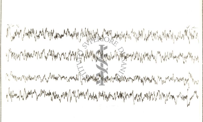 Circolazione cerebro-vascolare