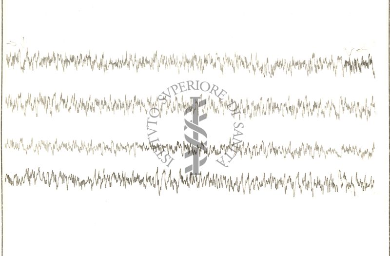 Circolazione cerebro-vascolare