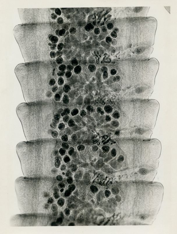 Raillietina tetragona Molin 1858 - Proglottide matura