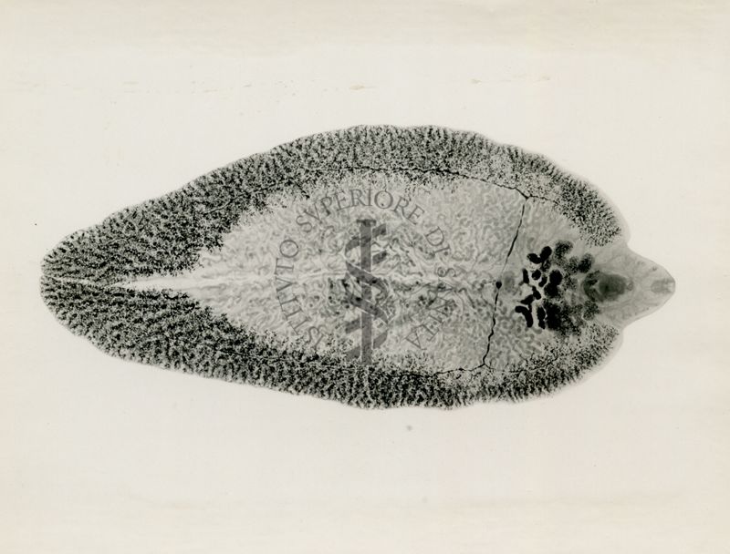 Fasciola epatica