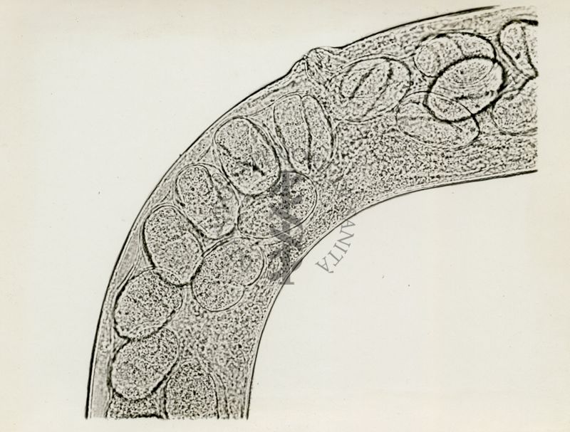 Cheilobus Russo (Penso 1941) - Parassita delle patate. Formazione vaginale