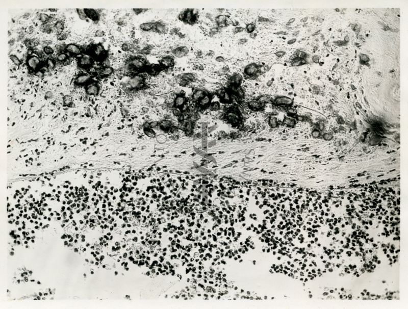 Calcificazioni nell'omento di un coniglio con Cysticercus pisiformis