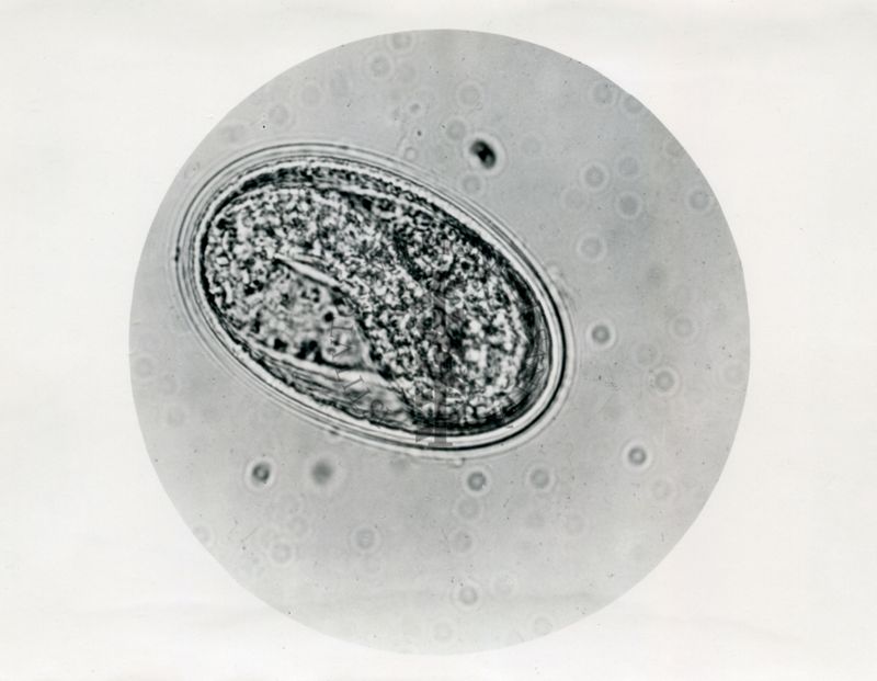 Ciclo di sviluppo dell'Ascaris lumbricoides