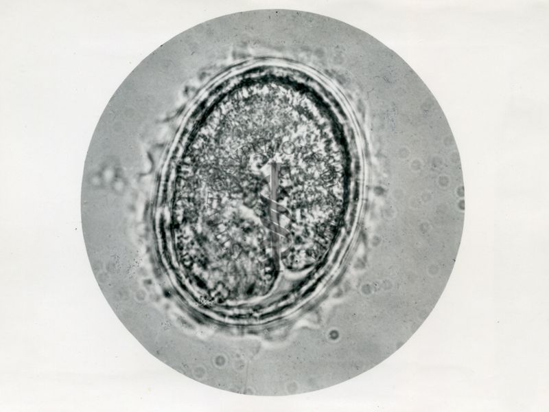 Ciclo di sviluppo dell'Ascaris lumbricoides