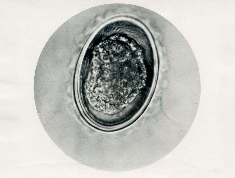 Ciclo di sviluppo dell'Ascaris lumbricoides