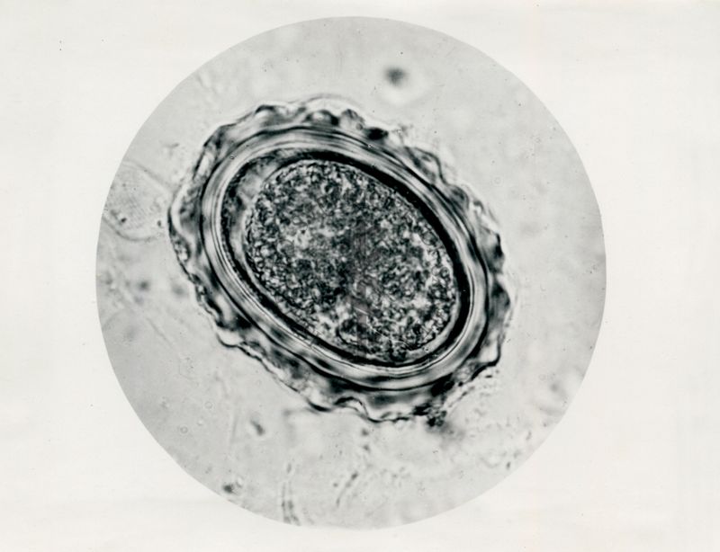 Ciclo di sviluppo dell'Ascaris lumbricoides