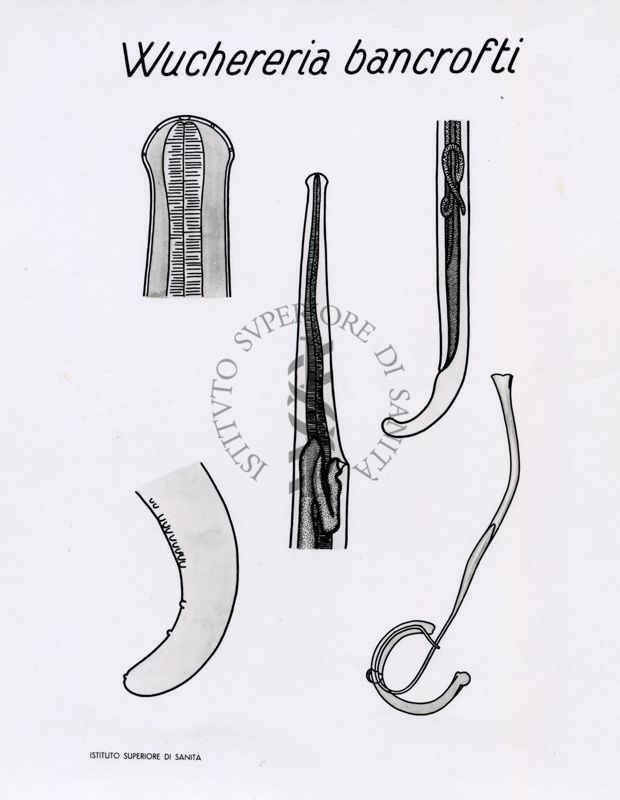 Wuchereria bancrofti