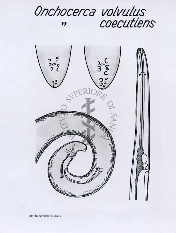 Onchocerca volvulus e coecutiens