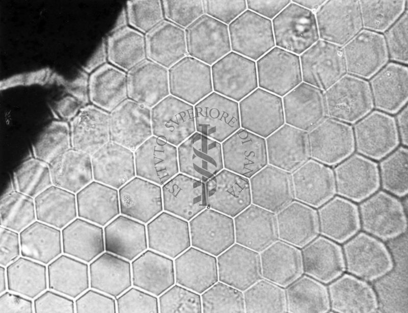 Faccette oculari e Pulvillo di I, II e III paio in musca domestica