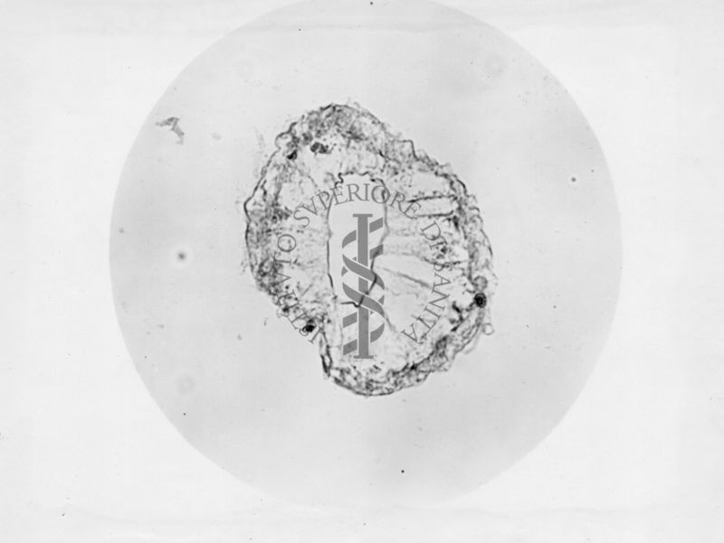 Genitali interni maschili di musca domestica