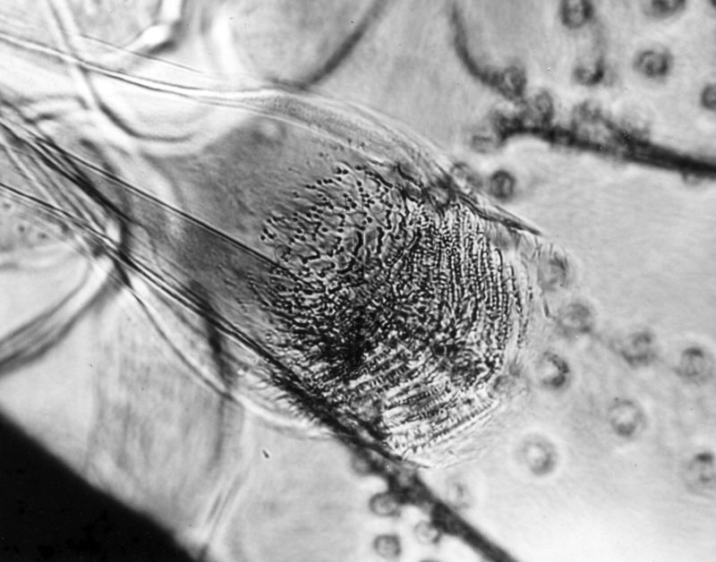 Differenze morfologiche fra le specie di Phlebotomus Perniciosus e Phlebotomus Perfiliewi