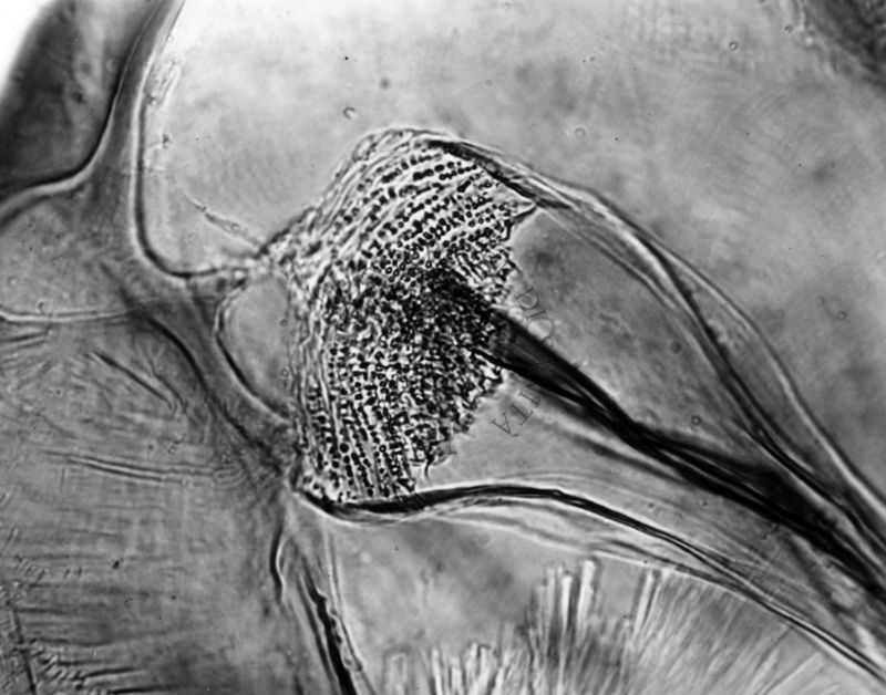 Differenze morfologiche fra le specie Ph. Perniciosus e Ph. Perfiliewi