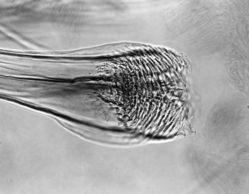 Differenze morfologiche fra le specie Ph. Perniciosus e Ph. Perfiliewi